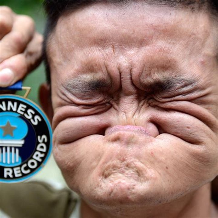 Exploring The Controversial "Ugliest Face In The World Record"