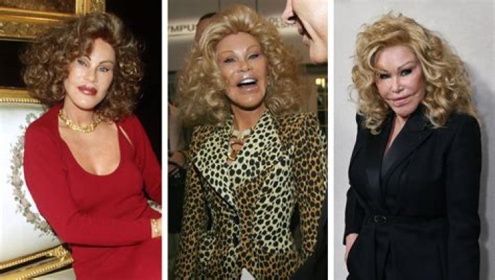 Unveiling Jocelyn Wildenstein's Youthful Beauty: A Surprising Journey