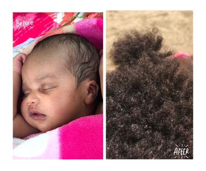 Your Journey To Luscious Hair